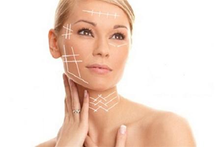Fili di Biostimolazione