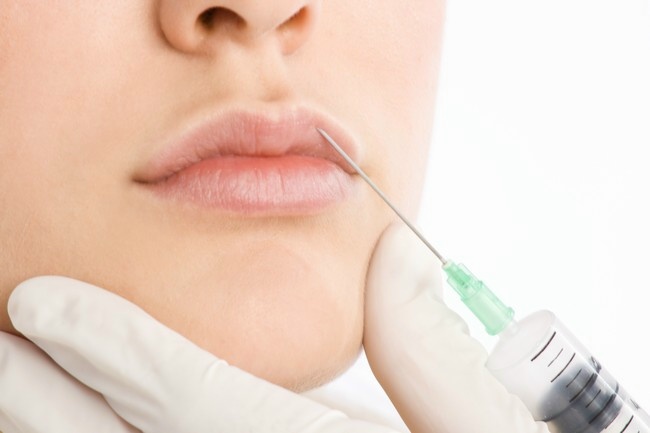 Filler Riempitivi